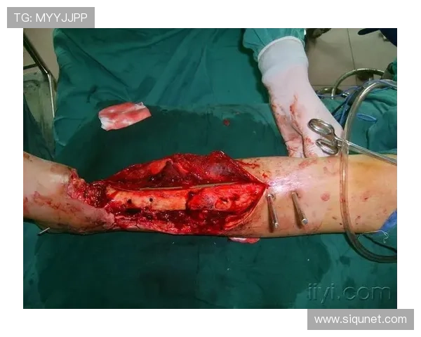 德岛漩涡山越康平踝伤解析